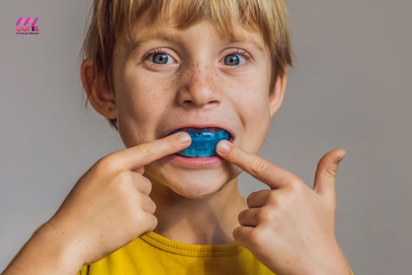 Niềng răng bằng khuôn cho trẻ em có hiệu quả không? 