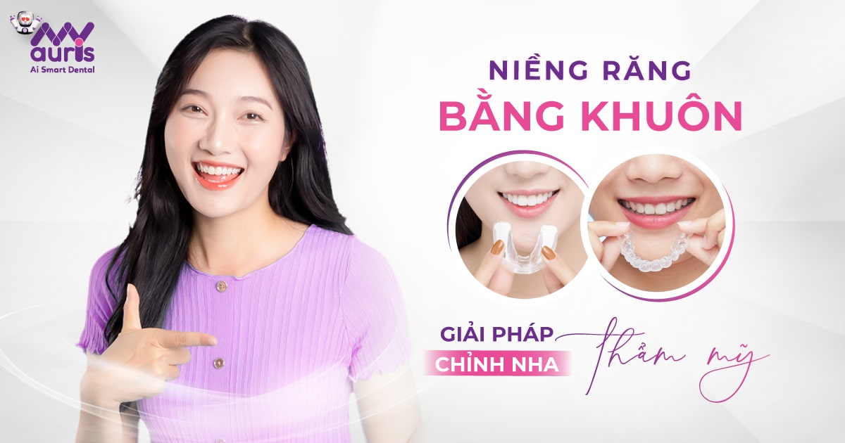 Niềng răng bằng khuôn