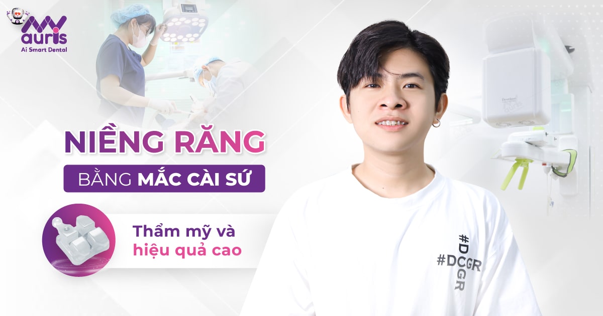 Niềng răng bằng mắc cài sứ