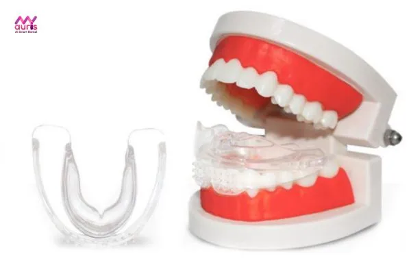 Như thế nào là niềng răng bằng nhựa silicon?