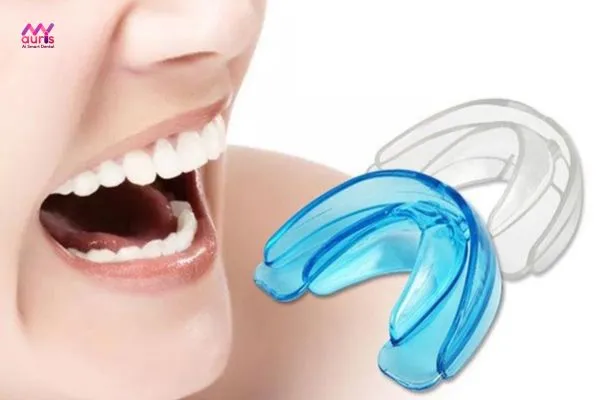 Niềng răng bằng nhựa silicon có hiệu quả không? 
