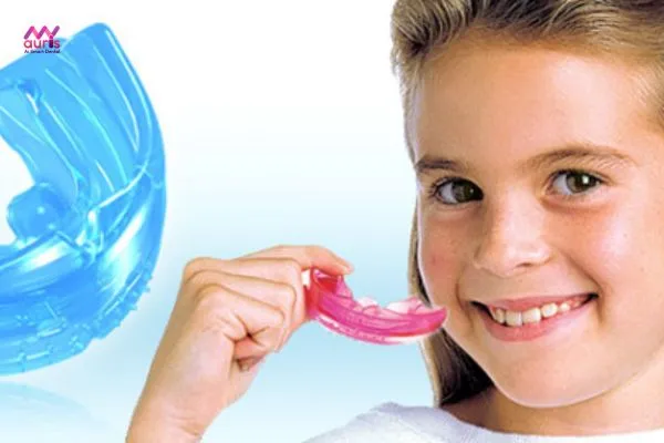 Niềng răng bằng nhựa silicon có hiệu quả không đối với trẻ em? 