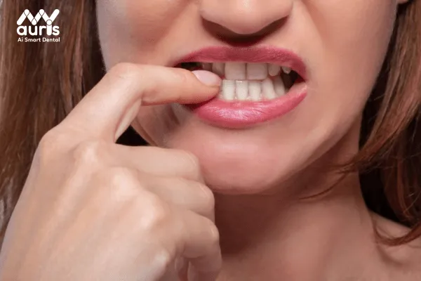 Tác hại của răng cụp mang lại cho người bệnh