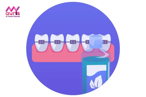 Bí quyết hỗ trợ giảm đau nhức khi niềng răng chỉnh nha