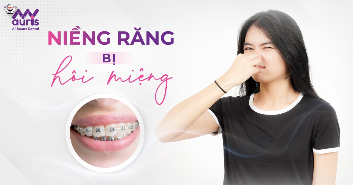 Niềng răng bị hôi miệng - 4 cách phòng ngừa hiệu quả