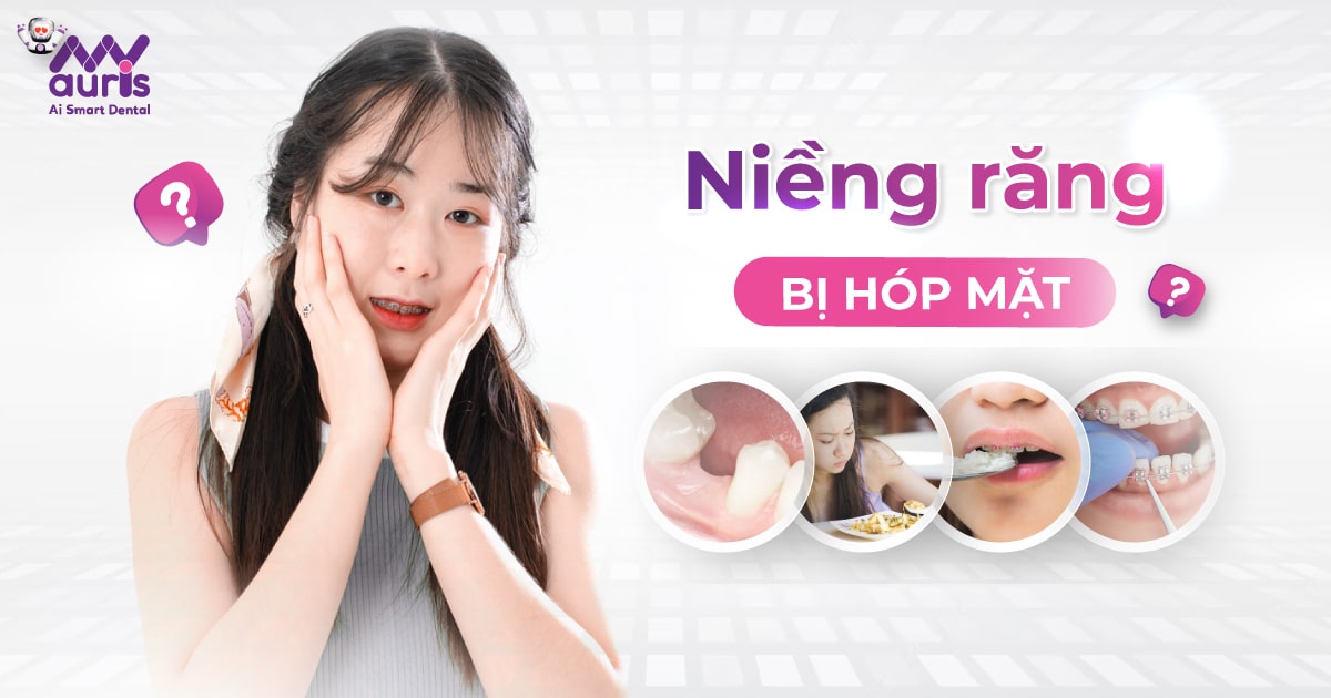 Niềng răng bị hóp mặt - 4 nguyên nhân cần chú ý