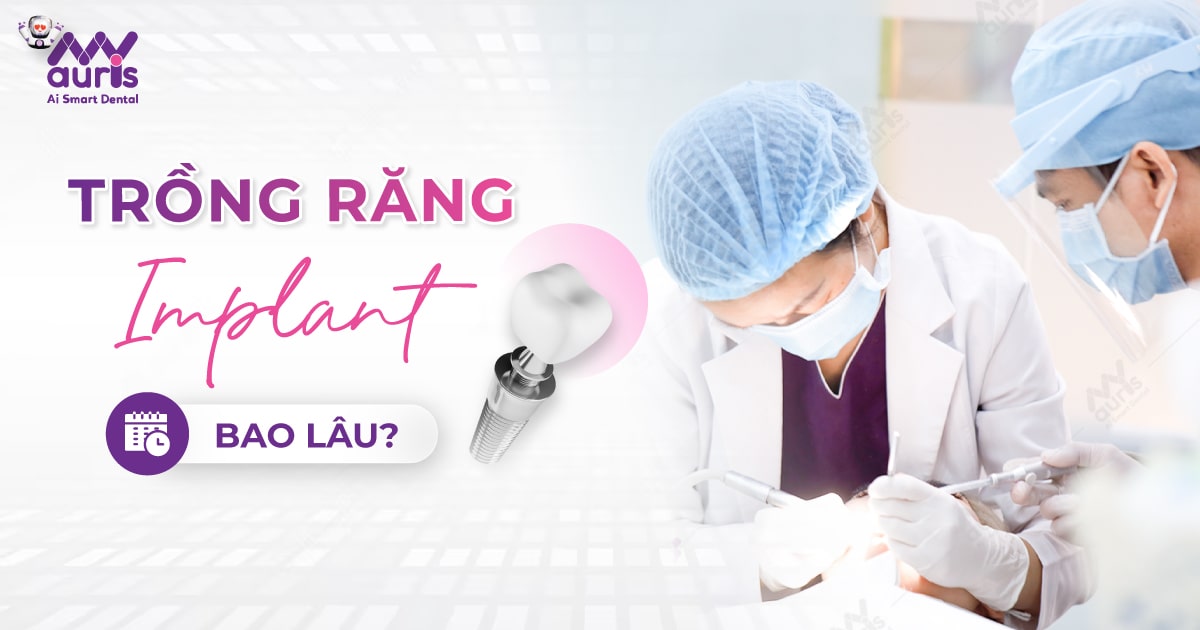 Quy trình trồng răng Implant mất bao lâu? (2 giai đoạn chính)