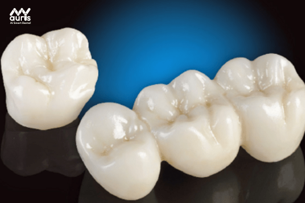 Tìm hiểu về răng sứ cao cấp cercon ht