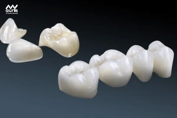 Ưu điểm của răng sứ cao cấp cercon ht 
