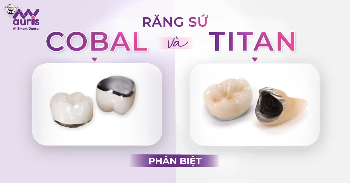 Răng sứ Cobal và Titan - 4 điểm phân biệt cần chú ý