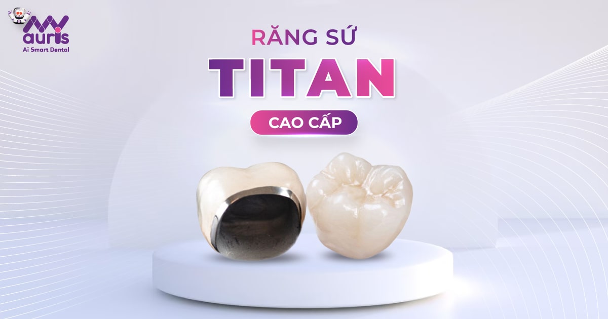 Răng sứ titan cao cấp - Tìm hiểu 5 ưu điểm chỉnh