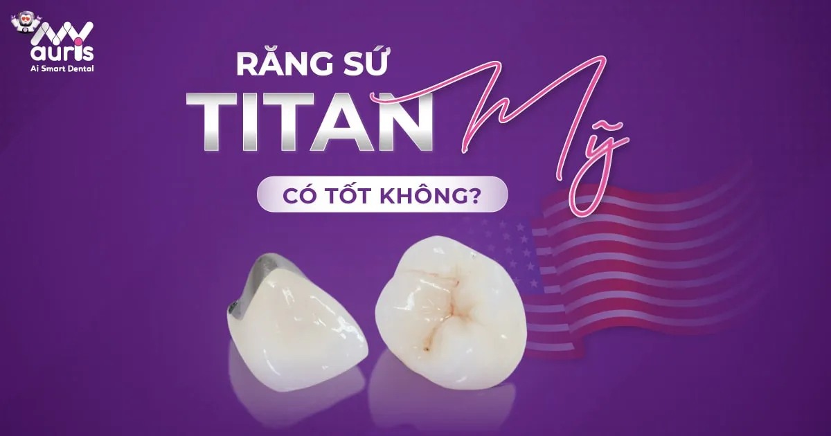 Răng sứ titan mỹ có tốt không?