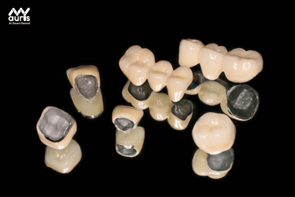 Các loại răng sứ titan 