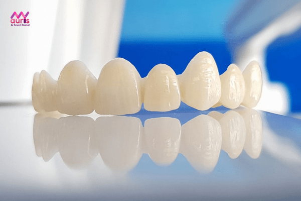 Tìm hiểu về răng toàn sứ cercon cad cam