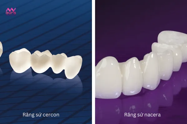 So sánh răng sứ cercon và nacera
