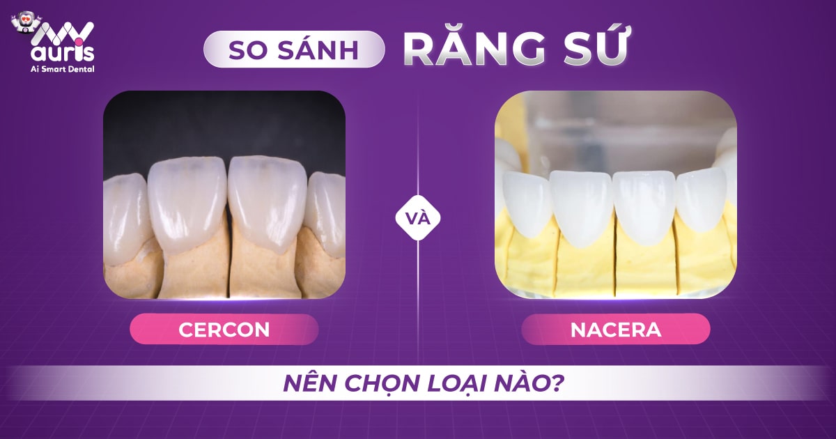 So sánh răng sứ cercon và nacera