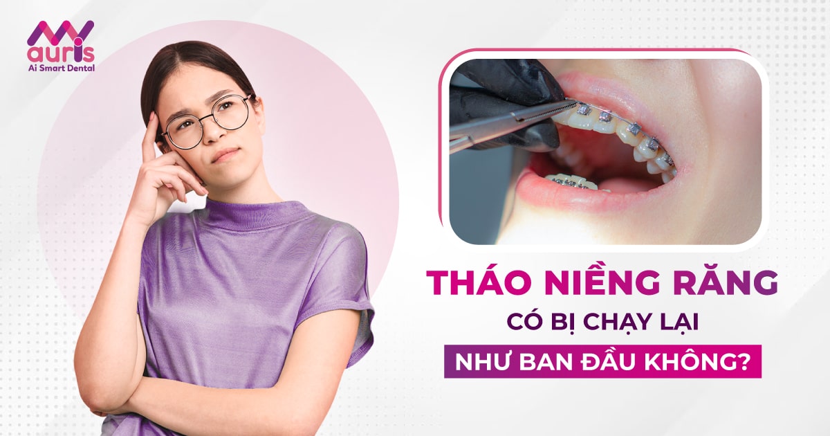 Tháo niềng răng có chạy lại không? (3 lý do chính)