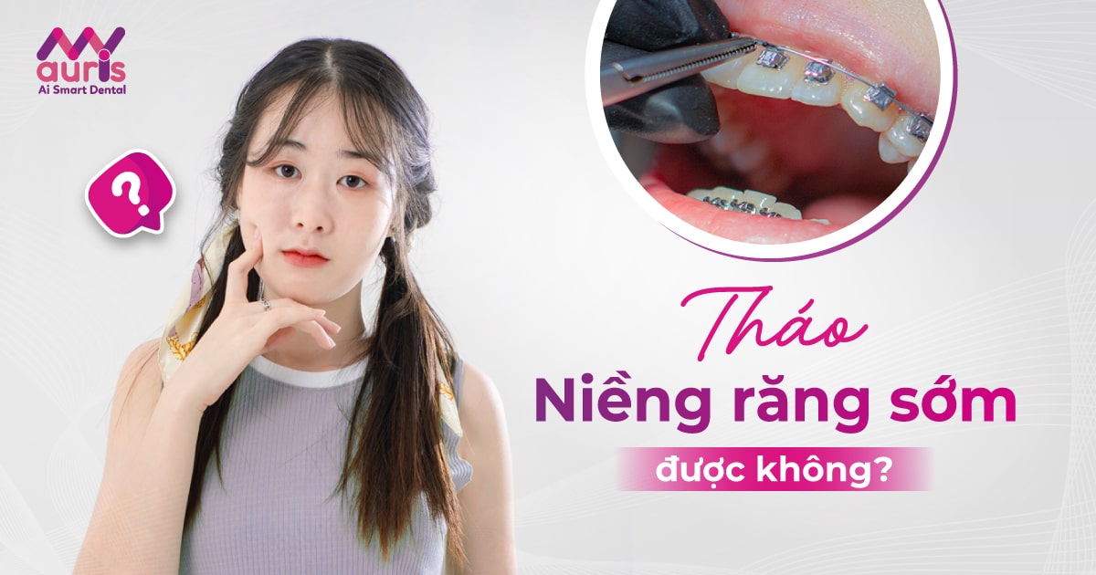 Tháo niềng răng sớm được không? - 5 yếu tố quyết định