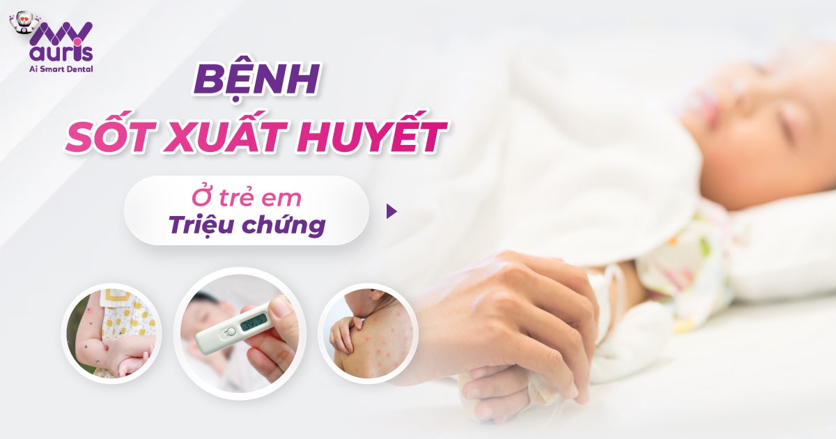 Triệu chứng của bệnh sốt xuất huyết ở trẻ em (3 giai đoạn)