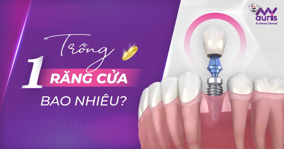 [Tư vấn nha khoa] Trồng 1 cái răng cửa bao nhiêu tiền?