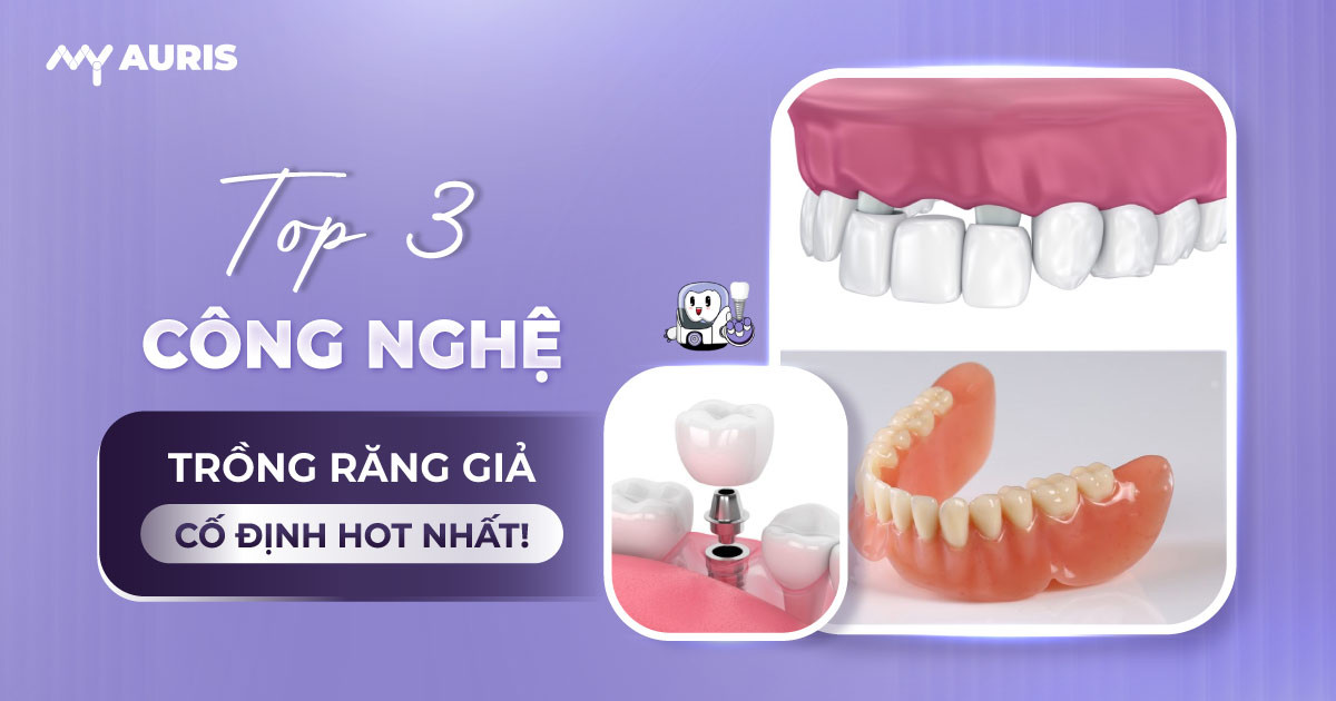 trồng răng cố định,trồng răng hàm giả cố định