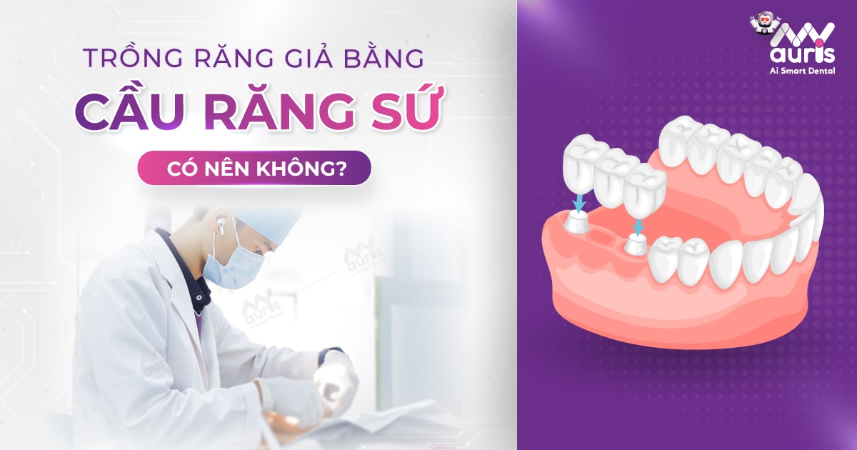 Trồng răng giả bằng cầu răng sứ