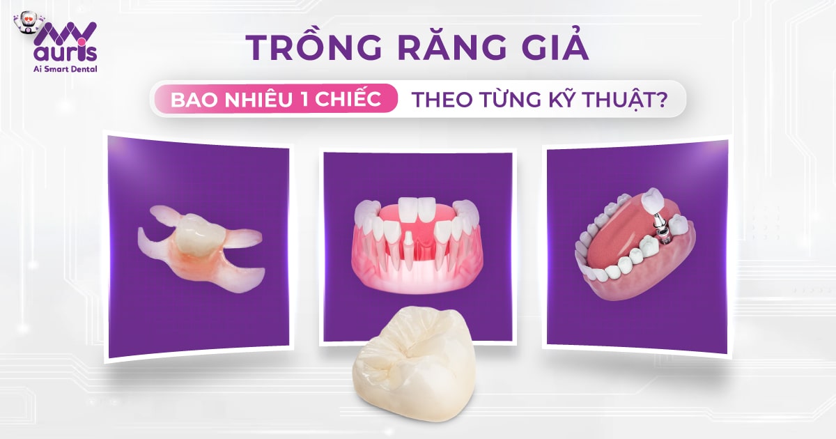 Trồng răng giả bao nhiêu 1 chiếc theo từng kỹ thuật?