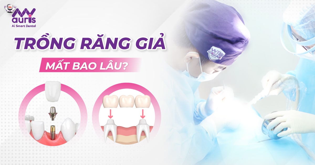 Trồng răng giả mất bao lâu? - 2 kỹ thuật chính