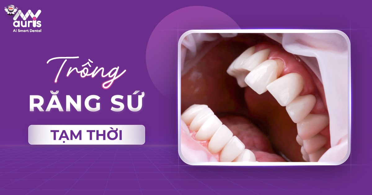 Trồng răng sứ tạm thời - Trong 2 trường hợp cụ thể