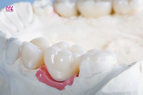 Trồng răng và làm răng giả là gì? 