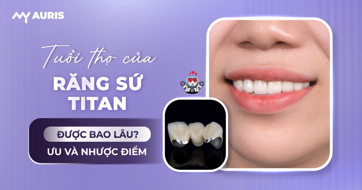 tuổi thọ của răng sứ titan