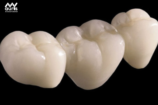 Tìm hiểu về răng sứ cercon 