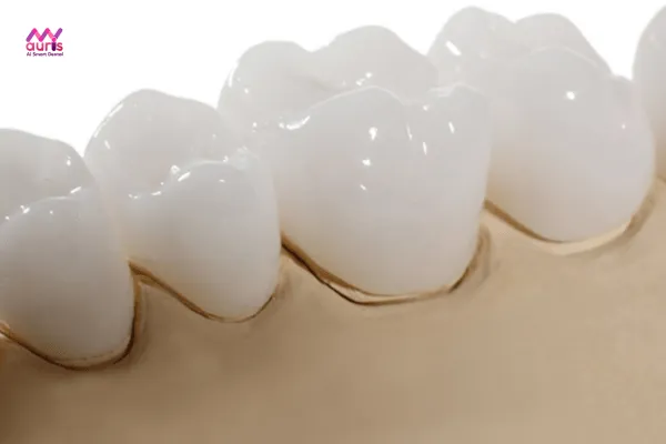 Răng sứ cercon zirconia - ưu nhược răng sứ không kim loại cercon là gì