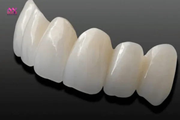 Răng sứ cercon HT - ưu nhược răng sứ không kim loại cercon là gì? 