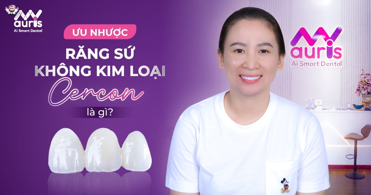 Ưu nhược răng sứ không kim loại cercon là gì?