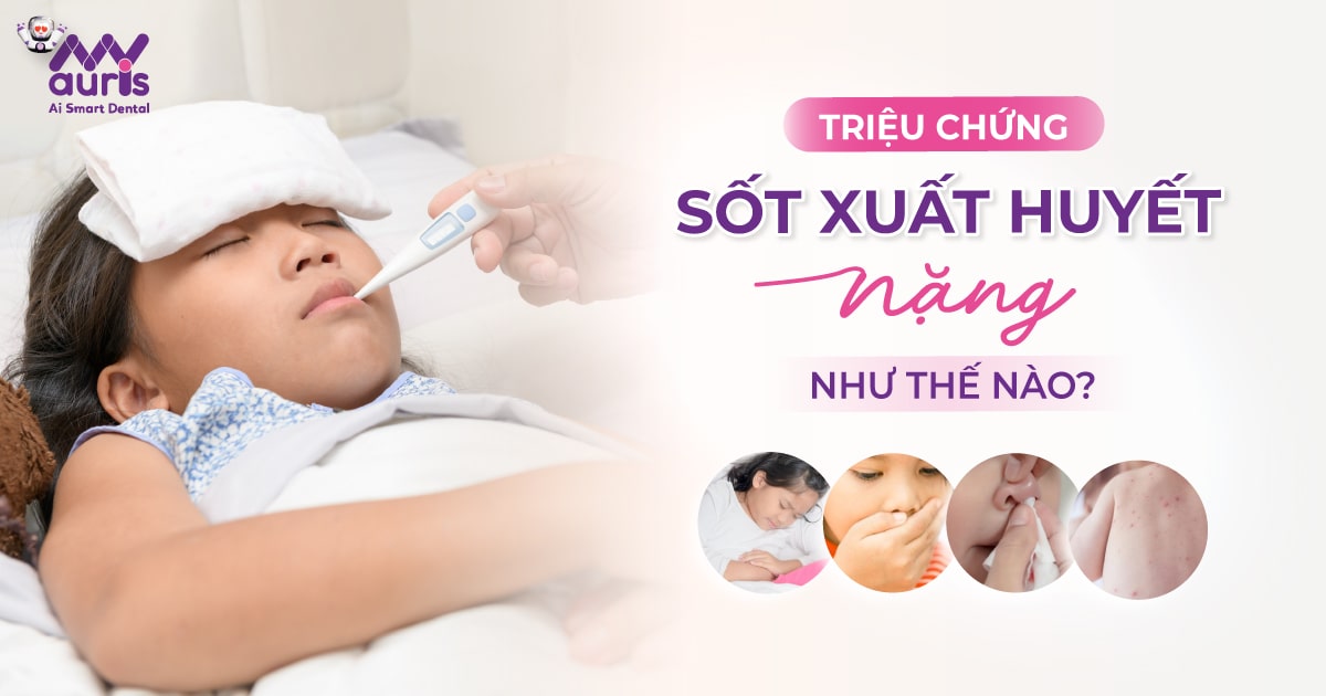 triệu chứng sốt xuất huyết nặng