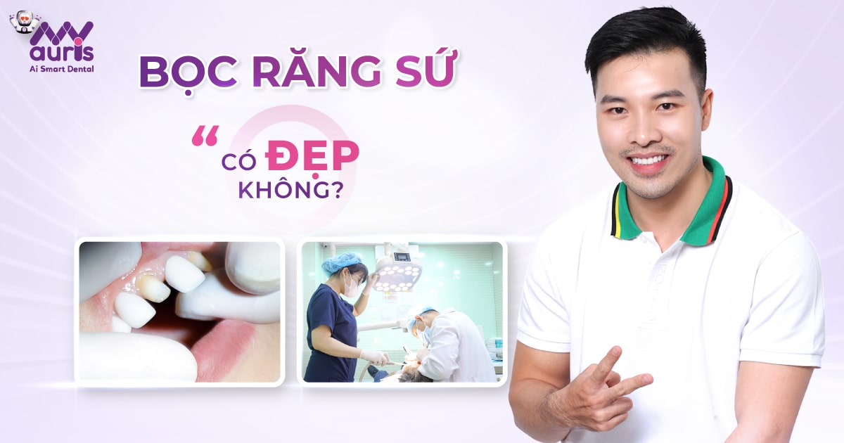 bọc răng sứ có đẹp không