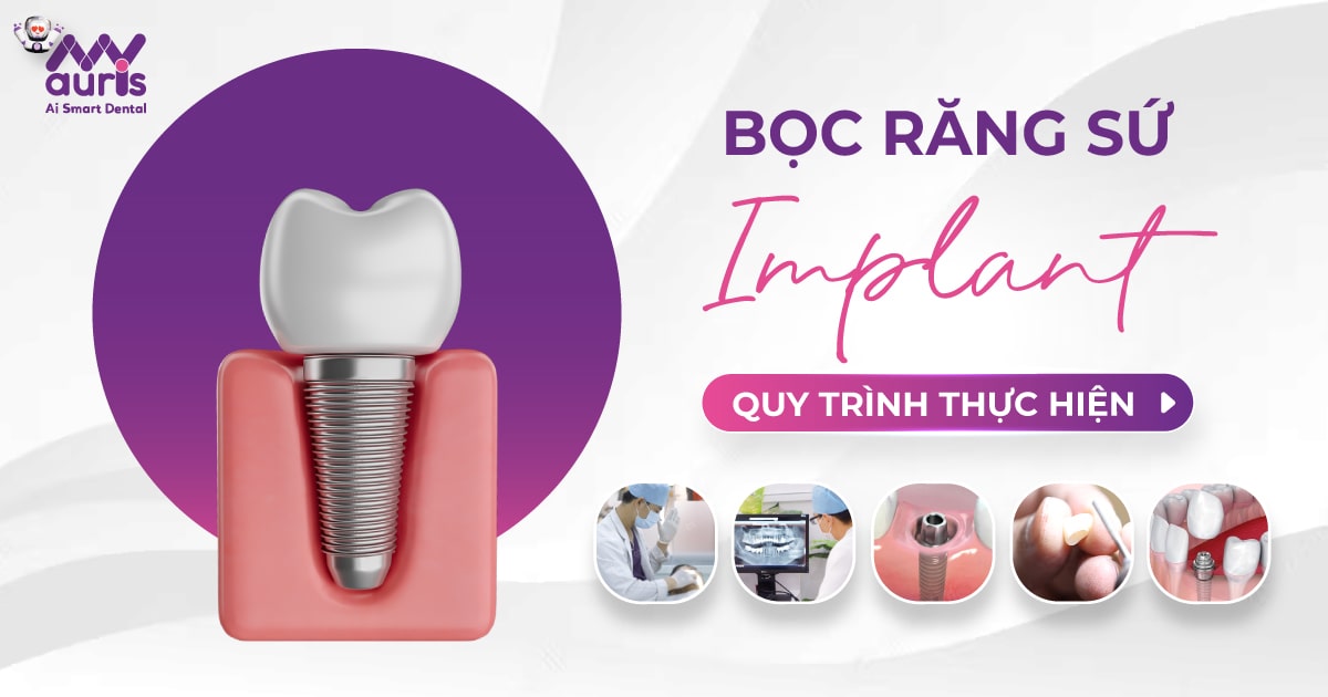 bọc răng sứ implant