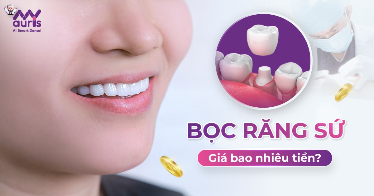 bọc răng sứ giá bao nhiêu tiền