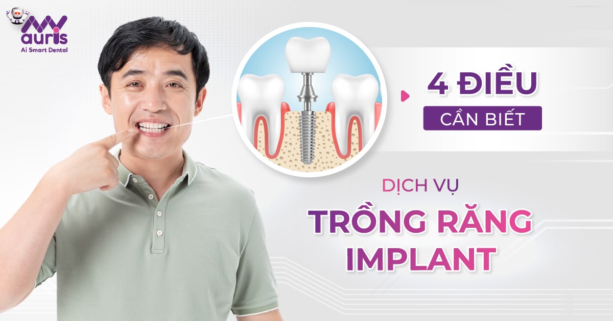 dịch vụ trồng răng implant