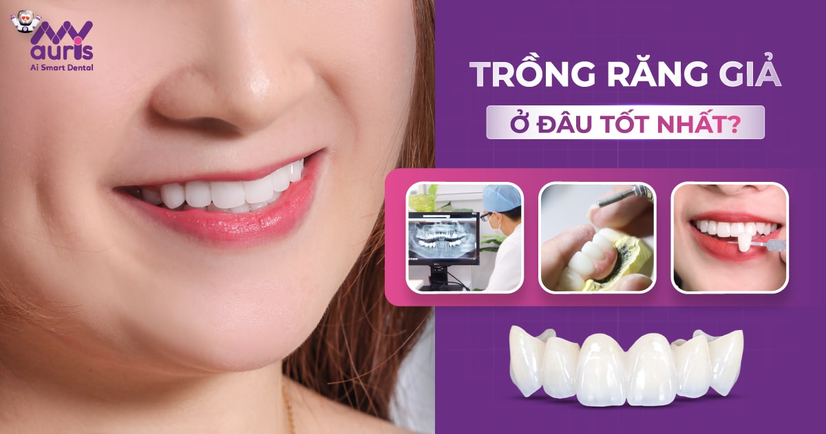 trồng răng giả ở đâu tốt nhất