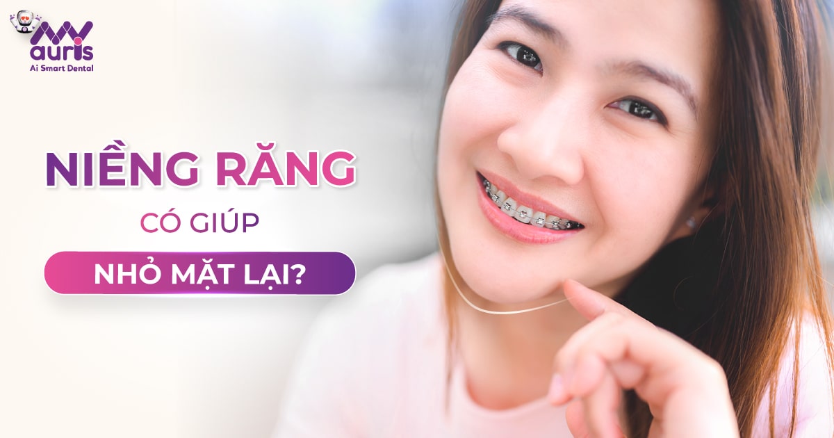 niềng răng có giúp mặt nhỏ lại