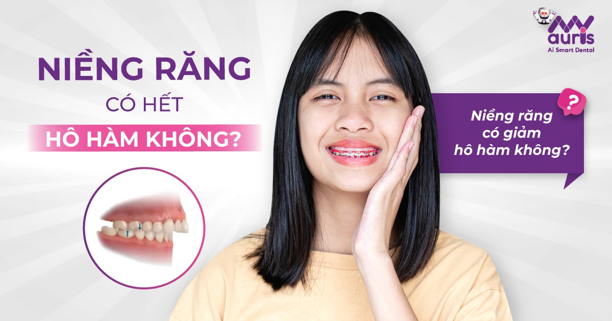 niềng răng có hết hô hàm không