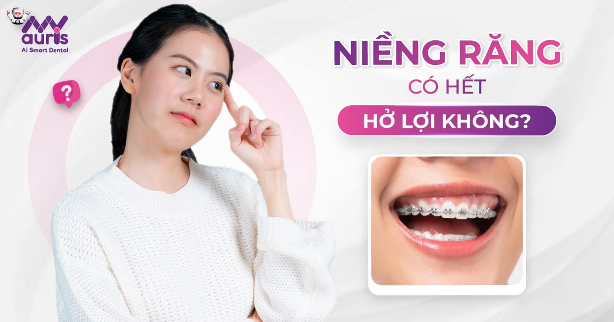 niềng răng có hết hở lợi không