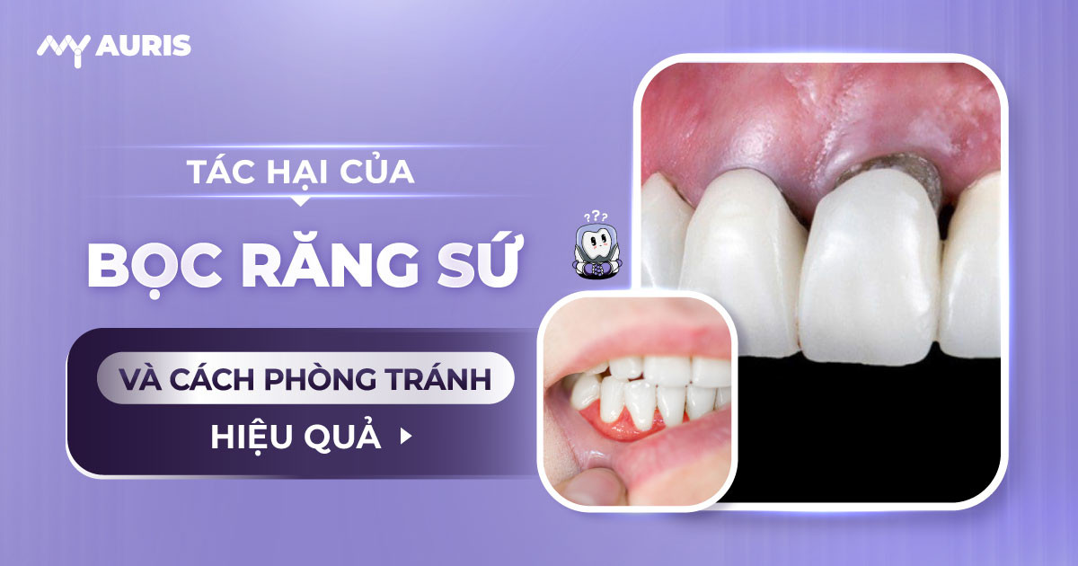 bọc răng sứ sau này có ảnh hưởng gì không, tại sao phải bọc răng sứ