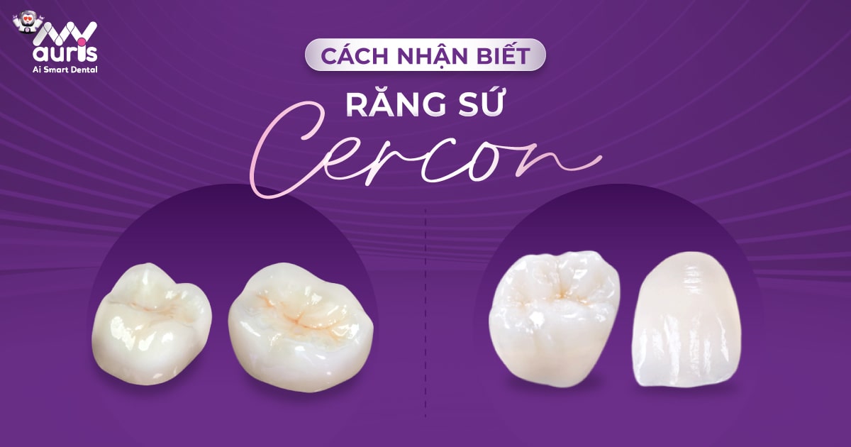 Cách nhận biết răng sứ Cercon theo 2 loại chính