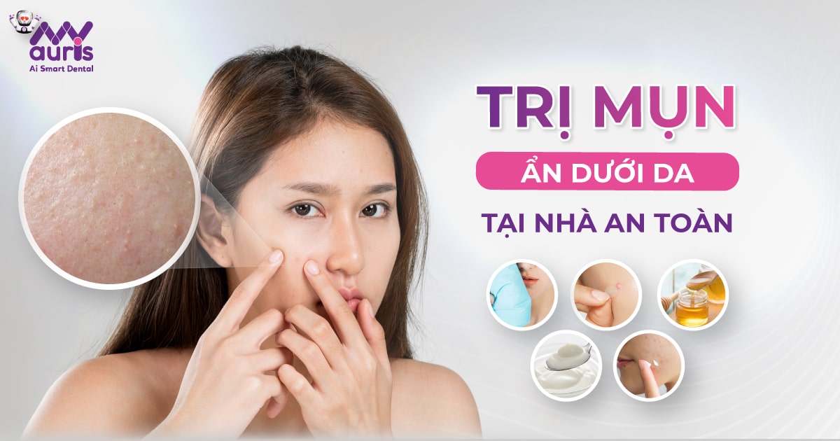 5 cách trị mụn ẩn dưới da tại nhà an toàn