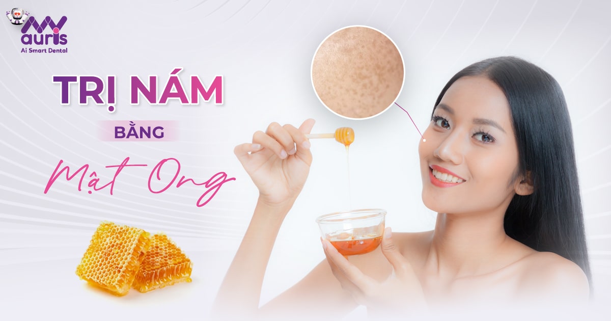 4 cách trị nám bằng mật ong hiệu quả ngay tại nhà