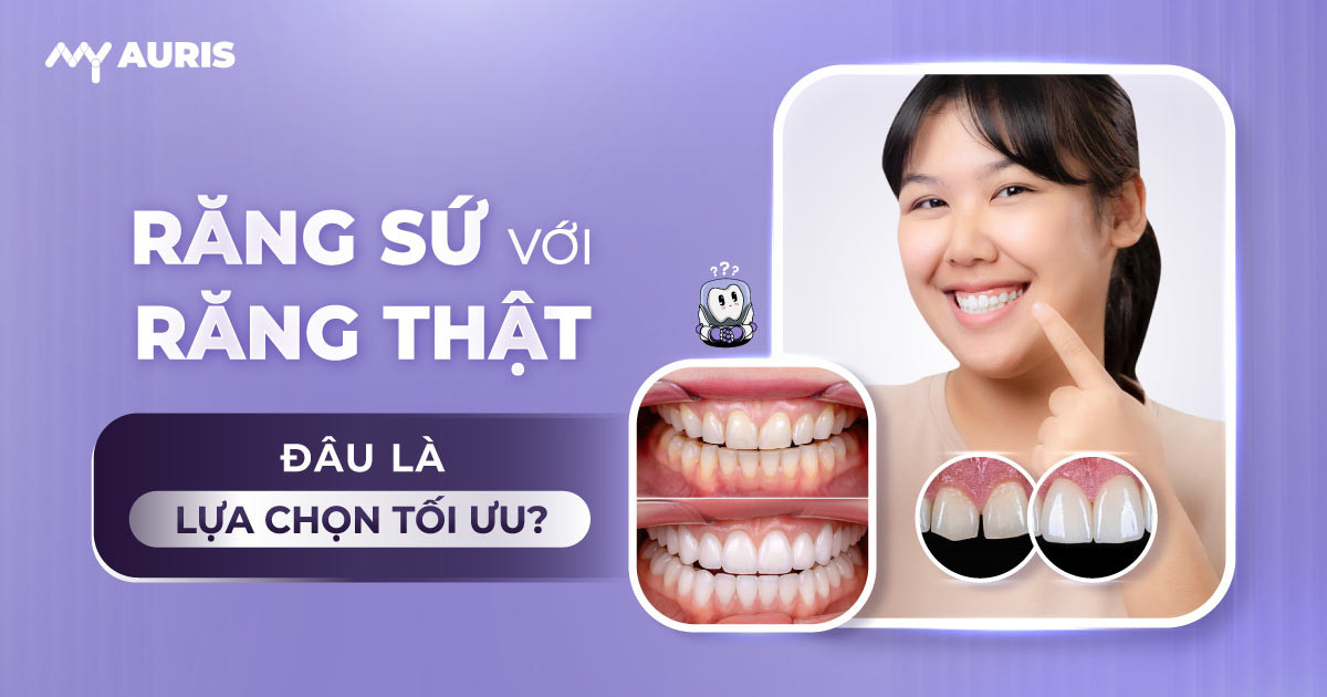 có nên bọc răng sứ không,bọc răng sứ có tốt không,mài răng bọc sứ,khi nào cần bọc răng sứ