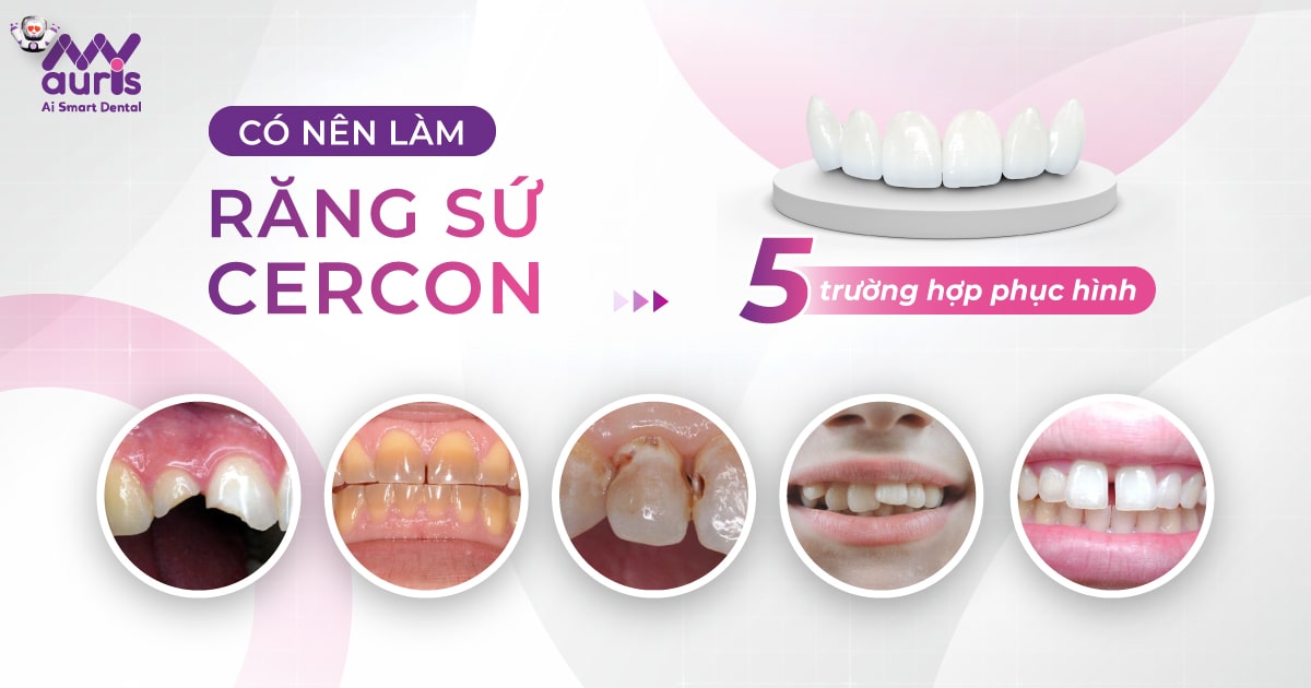 Có nên làm răng sứ cercon